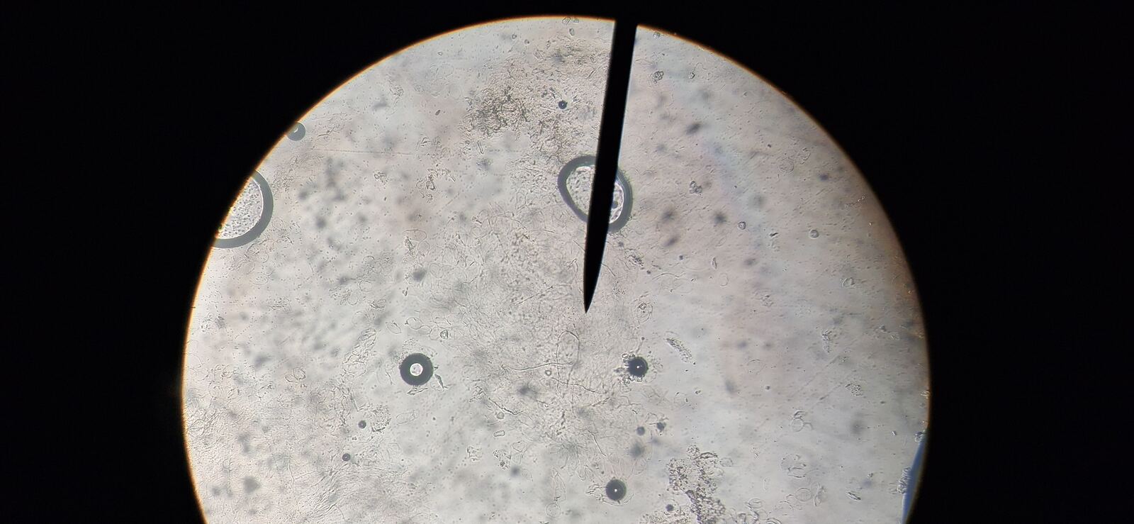 Tiña negra: imagen antes